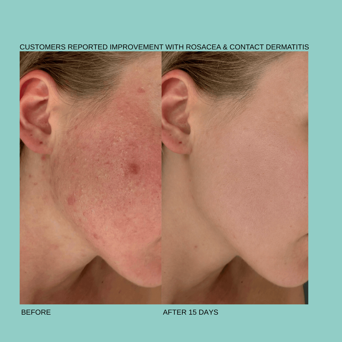Endorphi Hypochlorous Acid Face & Body Spray by Endorphi Skincare – hypochlorous acid face and body reset mist