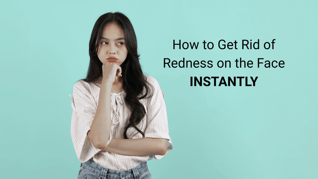 Re Getting Face How to Get Rid of Redness on the Face Instantly - Endorphi