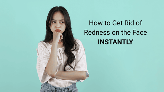 How to Get Rid of Redness on the Face Instantly - Endorphi