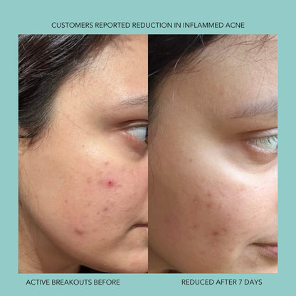 Endorphi Hypochlorous Acid Face & Body Spray by Endorphi Skincare – hypochlorous acid face and body reset mist