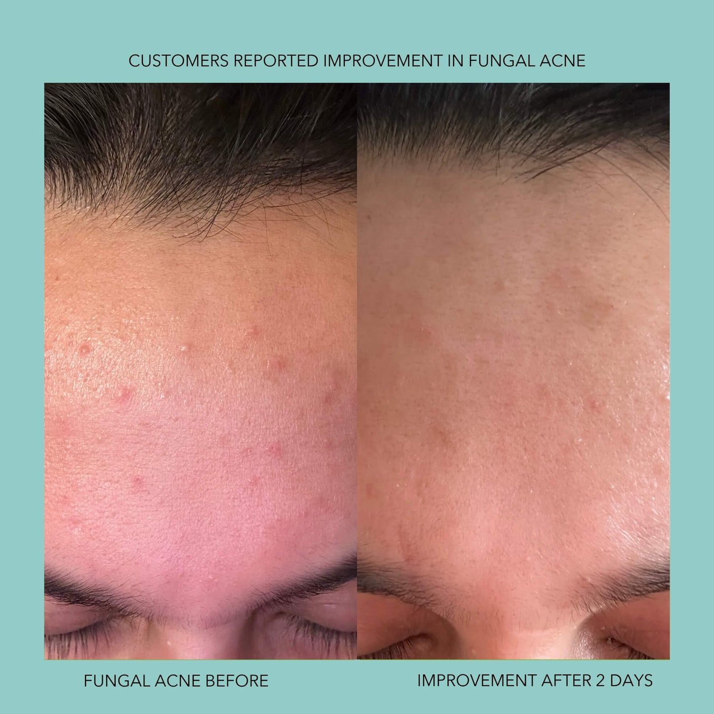 Endorphi Hypochlorous Acid Face & Body Spray by Endorphi Skincare – hypochlorous acid face and body reset mist