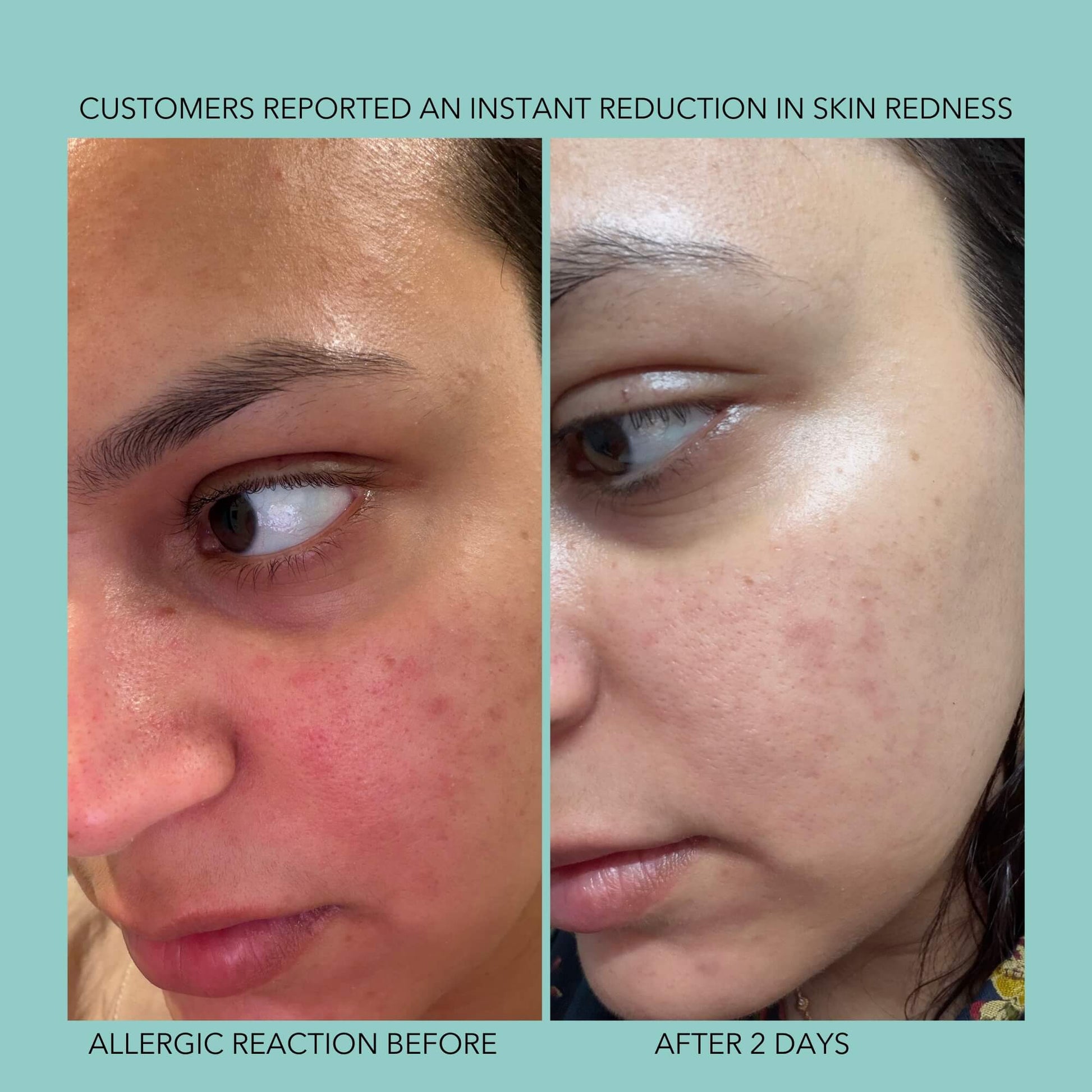 Endorphi Hypochlorous Acid Face & Body Spray by Endorphi Skincare – hypochlorous acid face and body reset mist