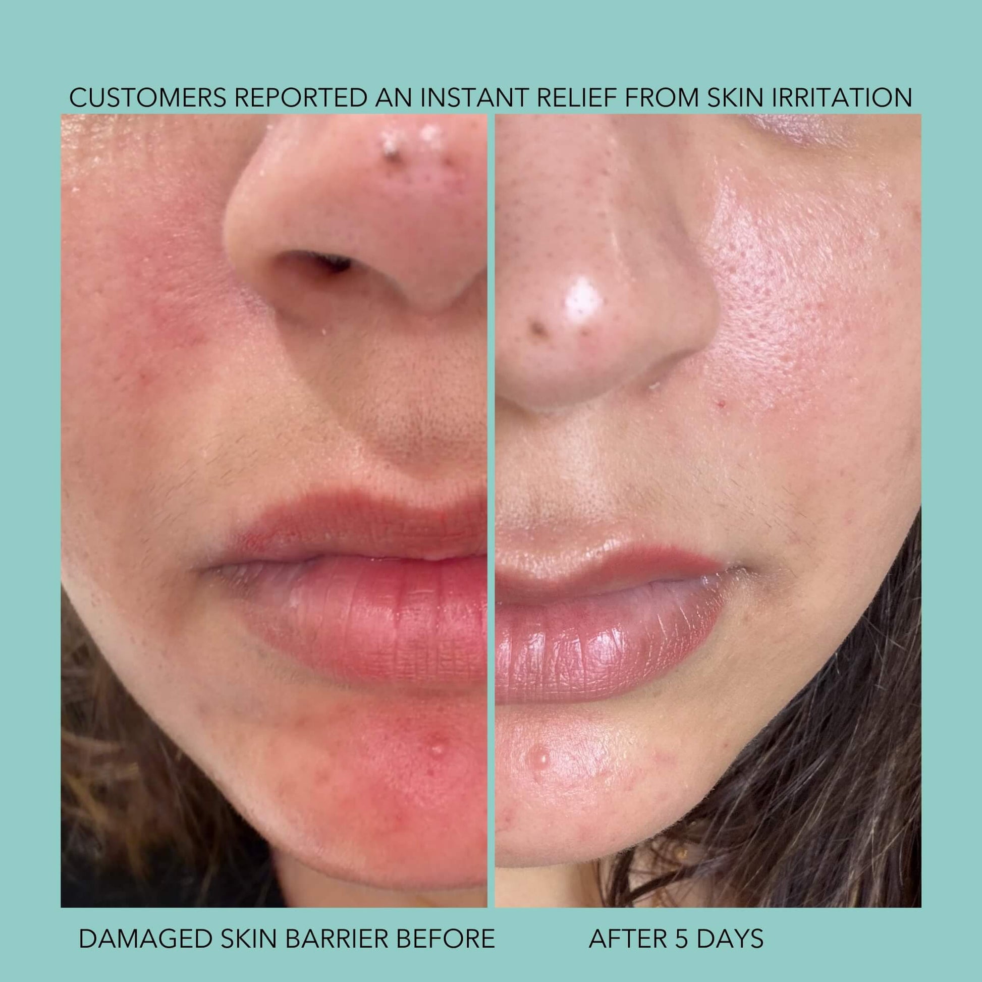 Endorphi Hypochlorous Acid Face & Body Spray by Endorphi Skincare – hypochlorous acid face and body reset mist