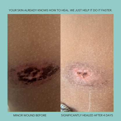 Endorphi Hypochlorous Acid Face & Body Spray by Endorphi Skincare – hypochlorous acid face and body reset mist